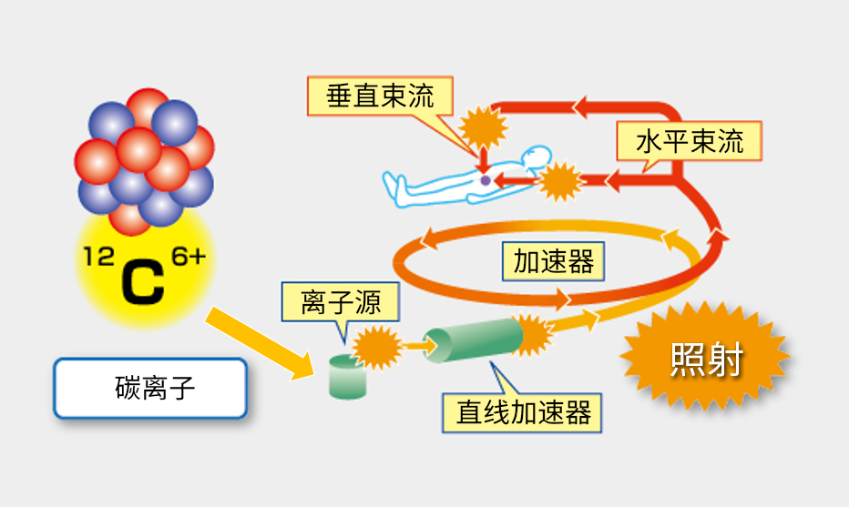 碳離子照射設(shè)備